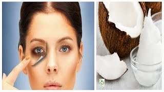 She Started Applying Coconut Oil Around Her Eyes 5 Minutes Later Unbelievable