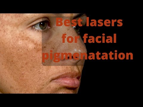 Crema per le mani di mavala contro posti di pigmentary Gli aquiloni per leggere il giorno di lentiggini