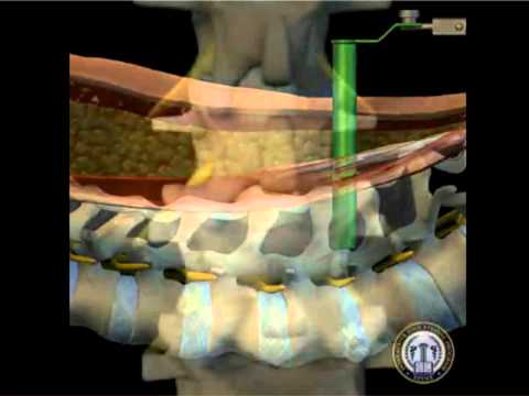 Dr. Geck - TLIF Animation