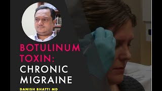 Botox for Migraine April 2024