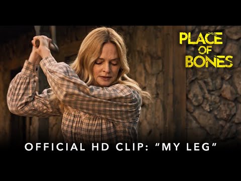 "My Leg"