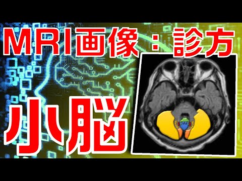 機能的磁気共鳴画像法について詳しく解説