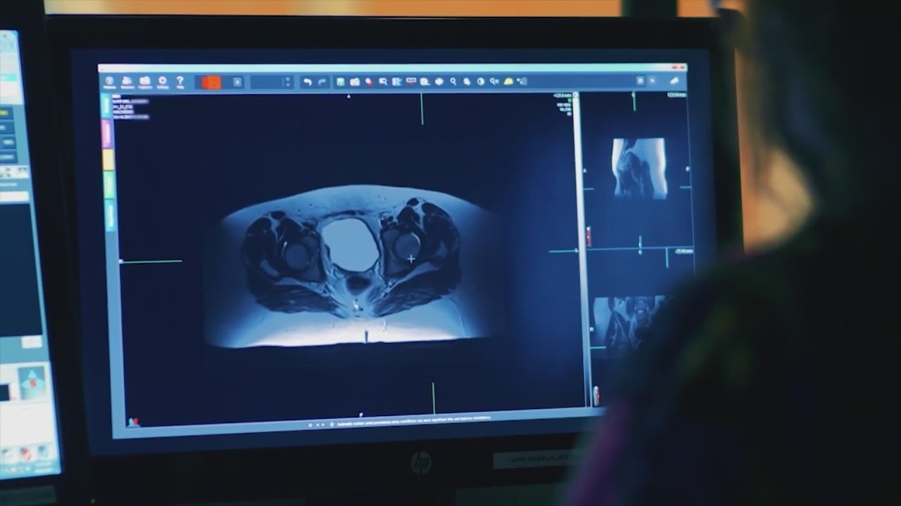 How St. Jude donations help cancer survival rates