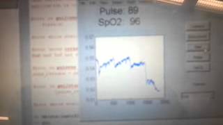 OSU ECE Senior Design Group 25 Transmission Test