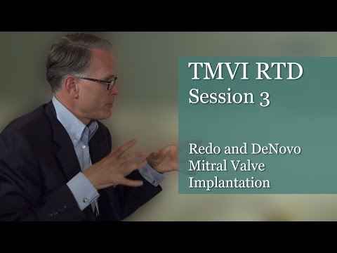 Transcatheter Mitral Valve Implantation (TMVI) Round Table - Session 3 - Redo & De Novo Implantation