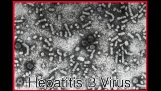 Hepatitis B Simplified