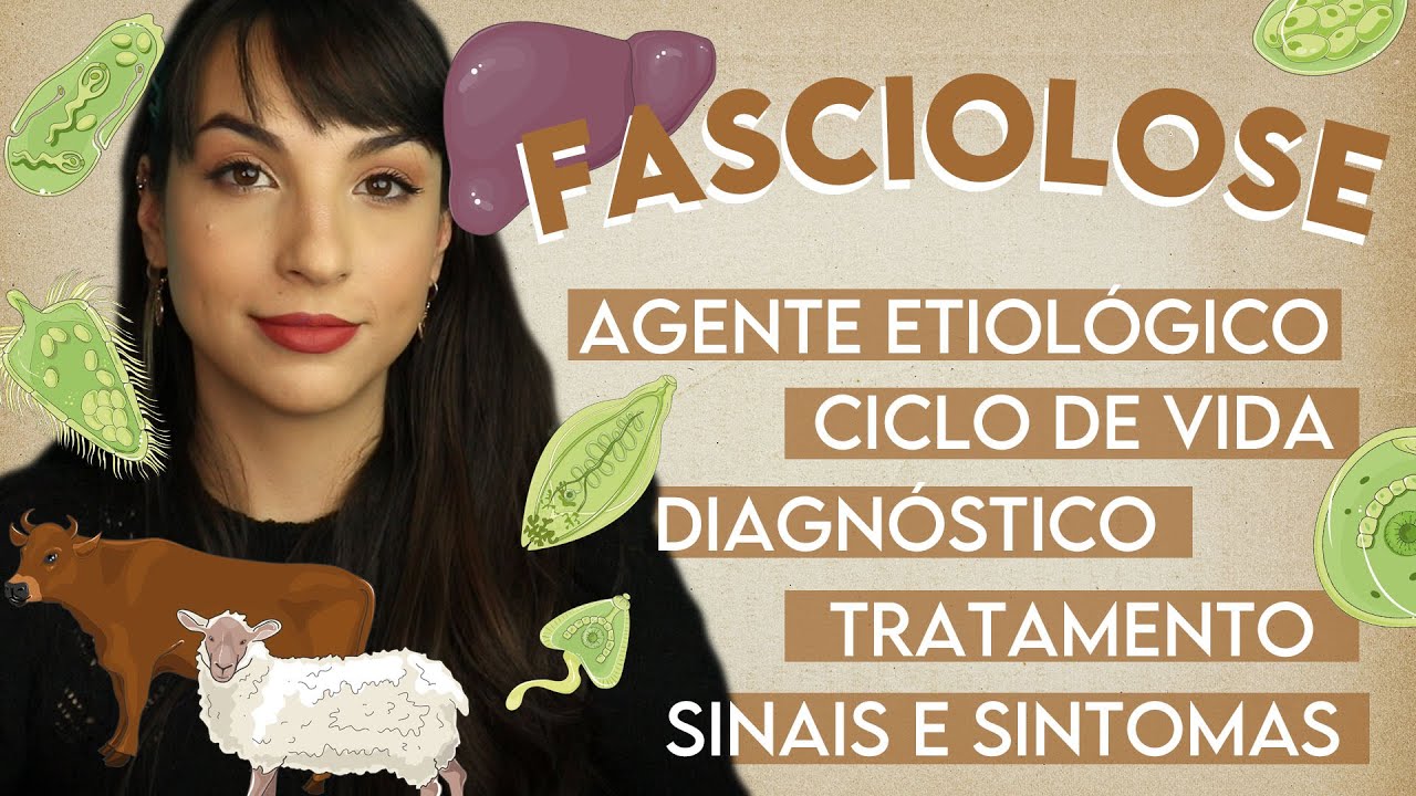 FASCIOLOSE: Fasciola hepatica | PARASITOLOGIA #20