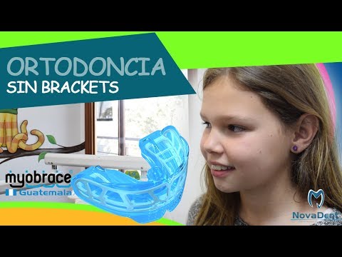 download lagu mp3 mp4 Myobrace Funciona, download lagu Myobrace Funciona gratis, unduh video klip Myobrace Funciona