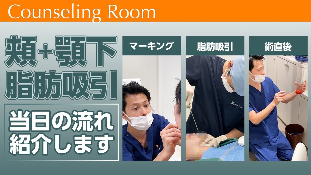 頬・顎下の脂肪吸引当日の流れをご紹介します！【Dr.吉江 脂肪吸引カウンセリング】