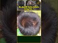 Do You Have Two Heads Thalalo Rendu Sudulu Unte Haripriys Media Yshorts