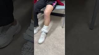 Patient recovery video thumbnail