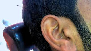 Blackheads in the Ear |pimples medication| @poppingblackheads