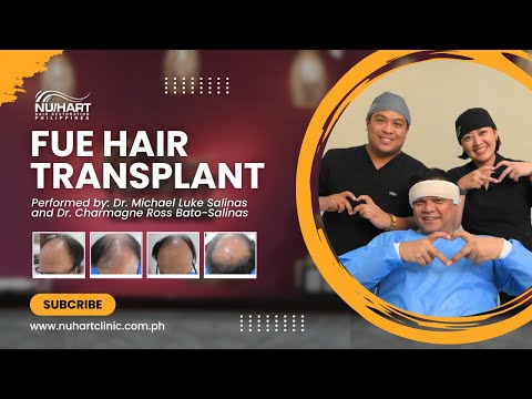 Urologist Dr. Jose Benito Abraham Undergoes FUE Hair Transplant | 𝗣𝗲𝗿𝗳𝗼𝗿𝗺𝗲𝗱 𝗯𝘆 𝗘𝘅𝗽𝗲𝗿𝘁 𝗦𝘂𝗿𝗴𝗲𝗼𝗻𝘀