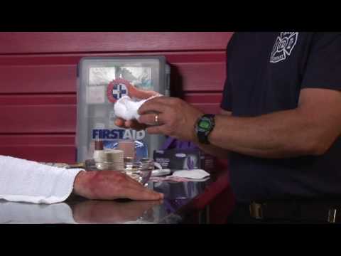 First Aid Tips : How to Treat a Burn in the Wilderness