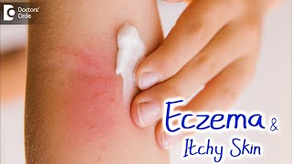 Best way to Moisturize & Soothe Dry, Itchy Skin due to Eczema-Dr.Amrita Hongal Gejje|Doctors