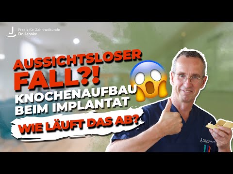 Bone augmentation for implants | Hope for hopeless cases! Why is this so important?