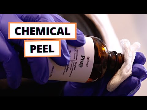 A Deeper Look into a CHEMICAL PEEL! (Medical Spa Promo)
