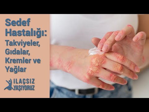 Sedef Hastalığı: Takviyeler, Gıdalar, Kremler ve Yağlar