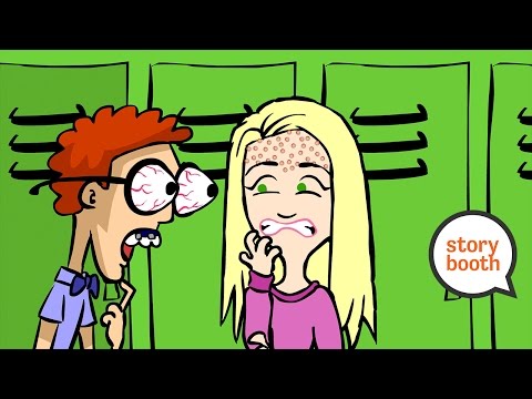 I Woke Up With Acne!