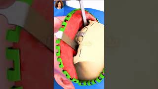 Feminização Facial