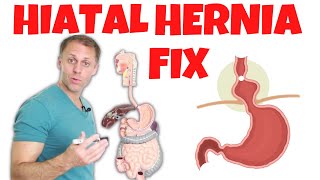 How to Fix a Hiatal Hernia