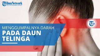 Othematoma, Penyakit yang Terjadi karena Adanya Kumpulan Darah pada Daun Telinga