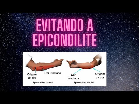 Epicondilite 🔥🔥🔥