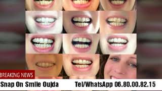 Snap on smile Oujda