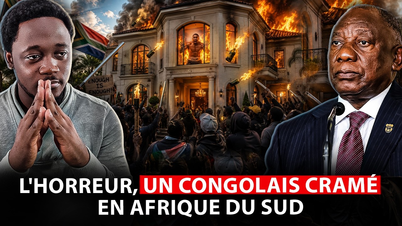Un boxeur congolais brulé en Afrique du sud, ils ont osé
