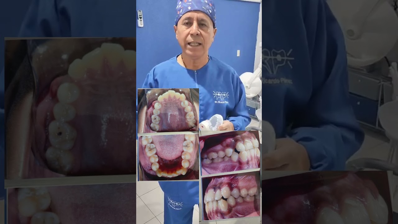 Ricardo Joel Pérez Pérez-10