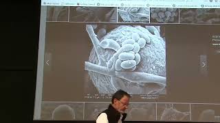 Lecture 9: Shape from Shading, General Case - From First Order Nonlinear PDE to Five ODEs