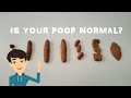 Are Your Bowel Movements Normal Here S What The Shape Of Your Poop Means