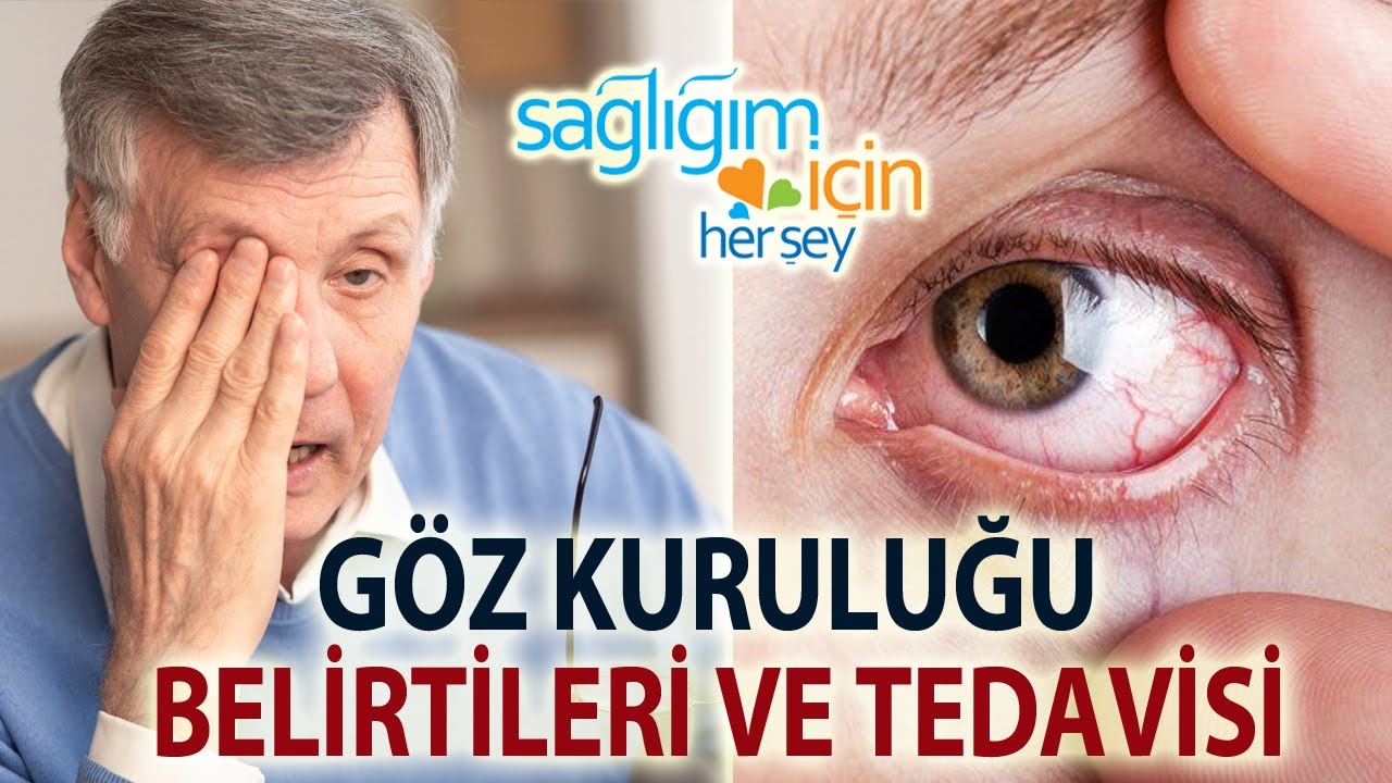 Göz Kuruluğu Belirtilerine Dikkat!