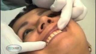 Clínica Dentilaser 1 Parte 1 - Dentilaser 