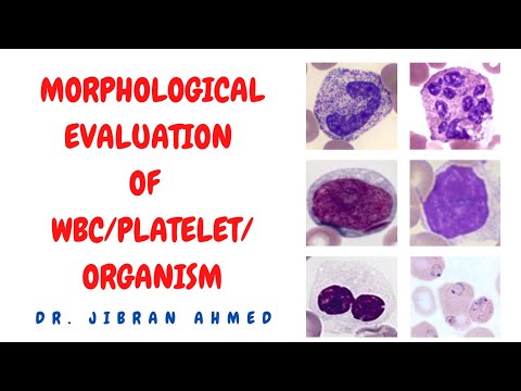OSTEOGENIC TX II FLETCHERS 5TH E II ROBBINS 10TH E II POST GRADUATE LEARNING II DrJIBRANAHMED