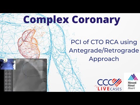 PCI of CTO RCA using Antegrade/Retrograde Approach - November 20, 2012 Webcast Video