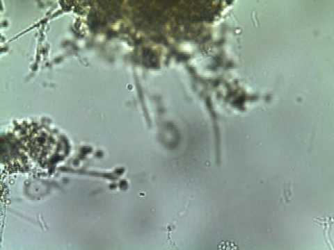 Ciliado reptante e bactérias livres (400 vezes de aumento)