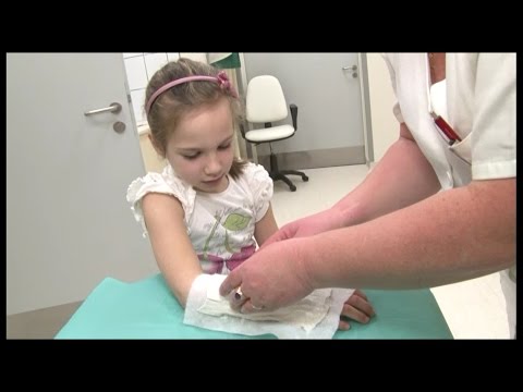 Orvosnál - Kéztörés