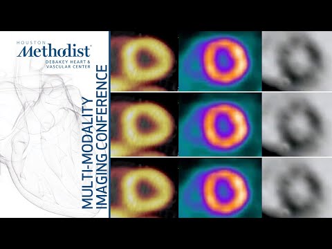 CV PET: Basic Principles and Current Applications (Mouaz Al-Mallah, MD) October 5, 2021