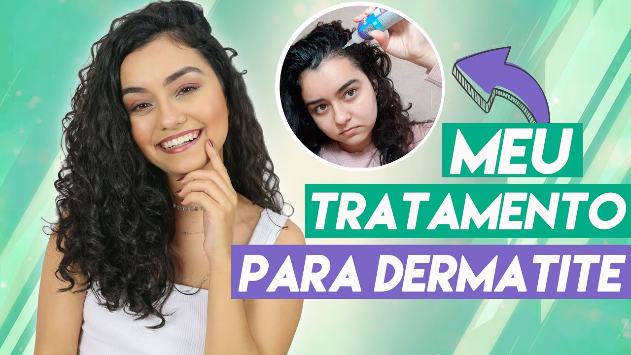 DICAS PARA DERMATITE SEBORREICA + atualização meu tratamento | Morena Raiz