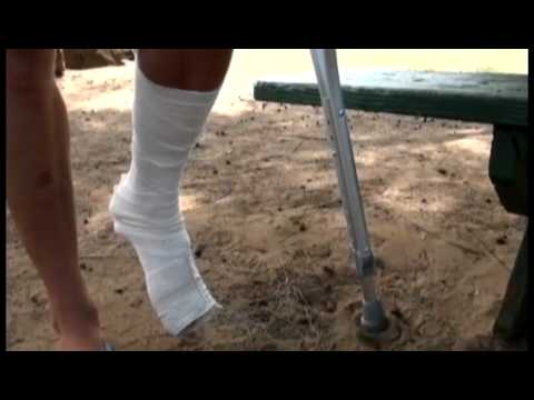 Man suffers shark bite on Kauai South Shore