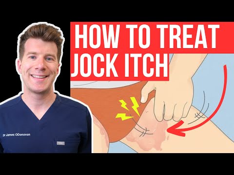 Doctor explains how to RECOGNISE AND TREAT JOCK ITCH (aka Tinea Cruris or Ringworm of the groin)...