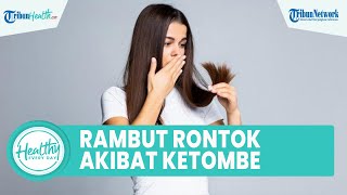 Rambut Kering hingga Rontok Bisa Disebabkan karena Ketombe, Begini Cara Mengatasinya