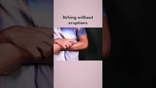 Download lagu Signs of liver damage mp3 Download lagu Signs of liver damage mp3