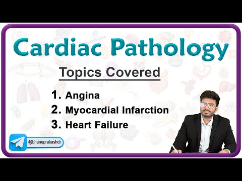 🫀 CVS Pathology (Part 2): Angina Pectoris, Myocardial infarction, Heart failure) Chapter - 5