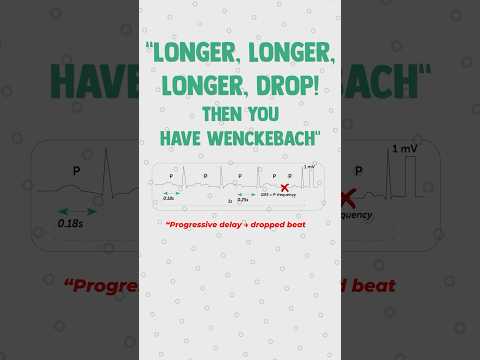 Heart Blocks made easy with this Poem 🫀✍️#medstudent #medschool  #usmlestep1 #usmle #cardiology