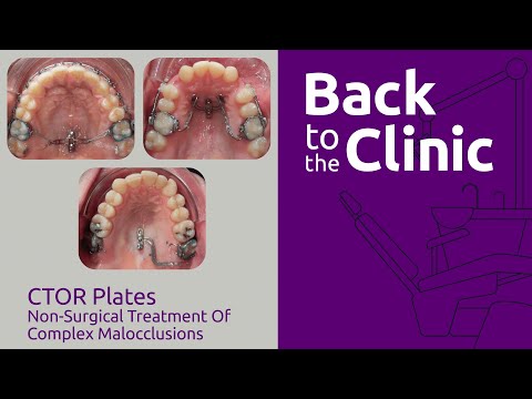 CTOR Plates: Non-surgical Treatment of Complex Malocclusions - Back to the Clinic #003