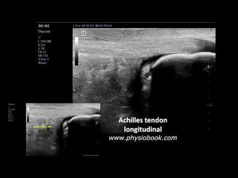 Dolore spasmodico bassa della schiena Dolore al pube osteocondrosi