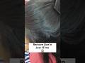 How To Remove Lice From Hair Lice Removal Home Remedies Shorts Ytshorts Haircare Viral