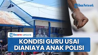 Miris! Guru di Sinjai Dipiting dan Dipukul Anak Polisi, Padahal Cuma Beri Sanksi Akibat Bolos